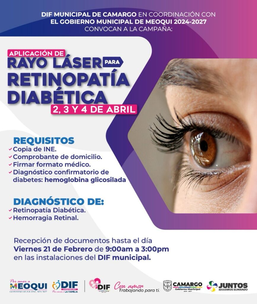 Gobierno Municipal de Camargo y Meoqui convocan a campaña de aplicación de rayo láser para retinopatía diabética
